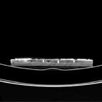 Figure 11: Axial image showing location of the three nails within the original wood.