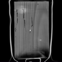 Figure 8: Coronal image 5, second panel, vertical wood grain