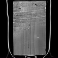 Figure 7: Coronal image 4, original wood and second panel (vertical grain)